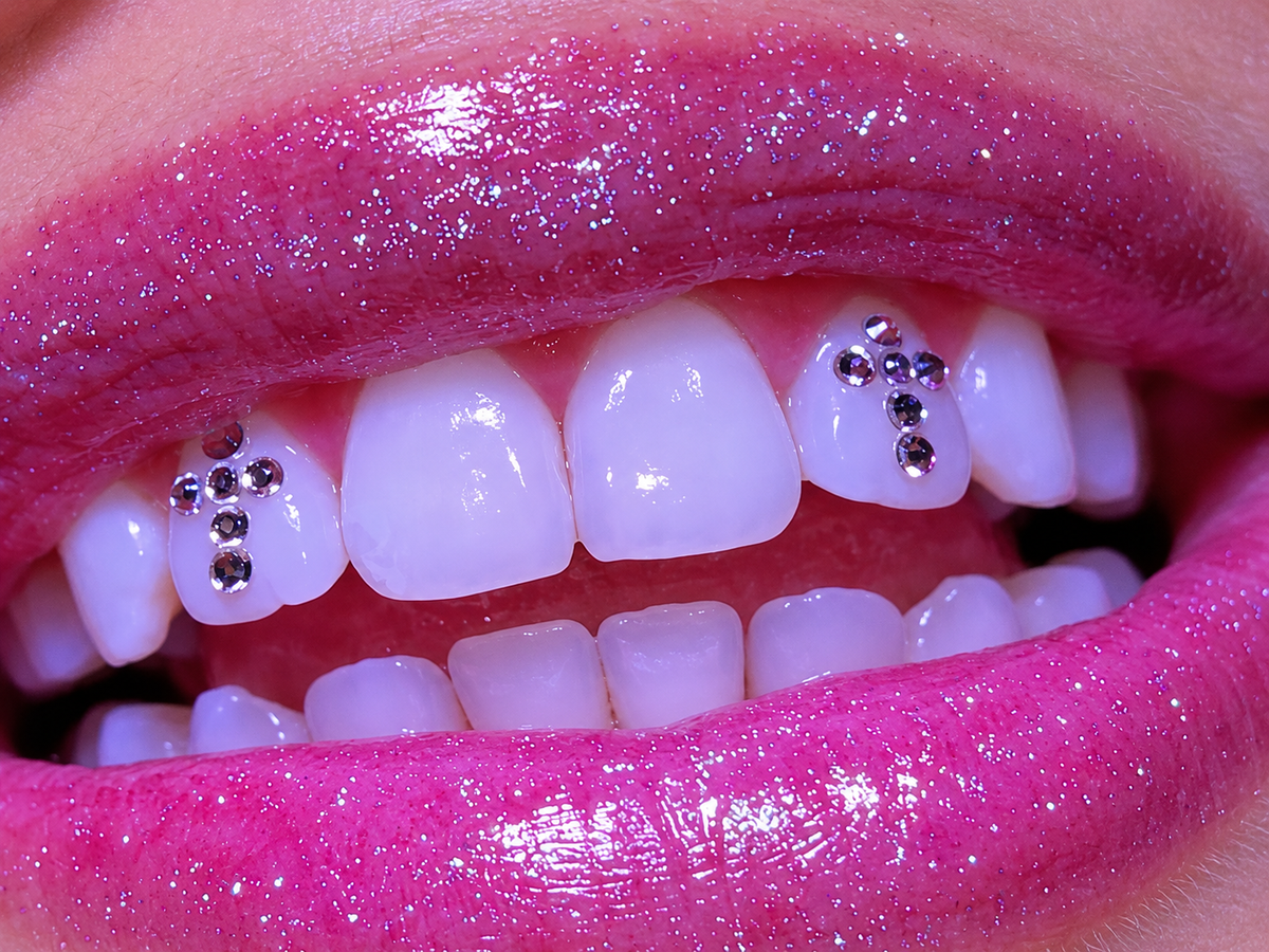 Cross Tooth Gems